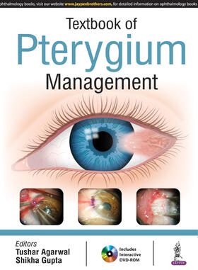 Agarwal / Gupta / Sharma |  Textbook of Pterygium Management | Buch |  Sack Fachmedien