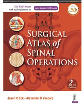 Eck / Vaccaro |  Surgical Atlas of Spinal Operations | Buch |  Sack Fachmedien