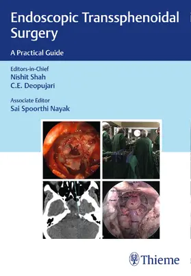 Shah |  Endoscopic Transsphenoidal Surgery | Buch |  Sack Fachmedien