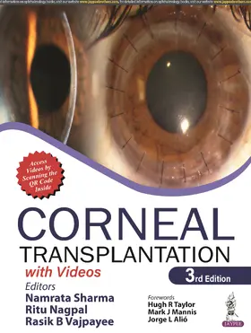 Sharma / Nagpal / Vajpayee |  Corneal Transplantation | Buch |  Sack Fachmedien