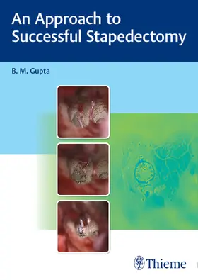 Gupta | An Approach to Successful Stapedectomy | Buch | 978-93-90553-10-5 | www2.sack.de
