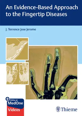 Jerome |  An Evidence-Based Approach to the Fingertip Diseases | eBook | Sack Fachmedien