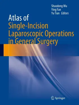Wu / Fan / Tian |  Atlas of Single-Incision Laparoscopic Operations in General Surgery | eBook | Sack Fachmedien
