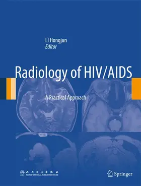 Li |  Radiology of HIV/AIDS | Buch |  Sack Fachmedien