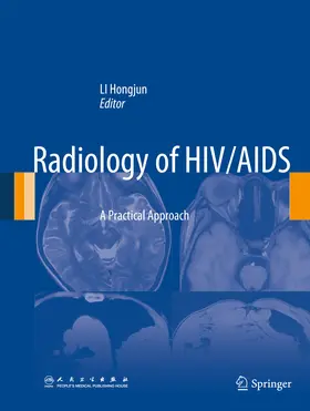 Li | Radiology of HIV/AIDS | E-Book | sack.de