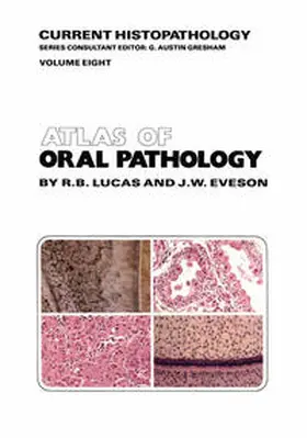 Lucas / Eveson |  Atlas of Oral Pathology | eBook | Sack Fachmedien