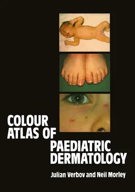 Verbov / Morley |  Colour Atlas of Paediatric Dermatology | Buch |  Sack Fachmedien