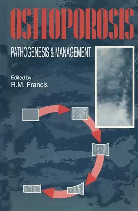 Francis |  Osteoporosis | Buch |  Sack Fachmedien