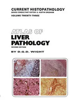 Wight | Atlas of Liver Pathology | E-Book | www2.sack.de