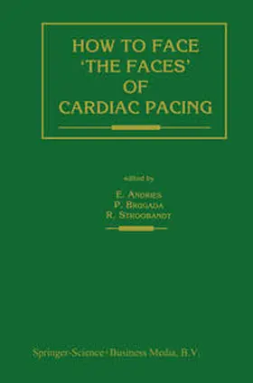 Andries / Brugada / Stroobandt |  How to face ‘the faces’ of CARDIAC PACING | eBook | Sack Fachmedien