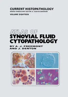 Freemont / Denton |  Atlas of Synovial Fluid Cytopathology | eBook | Sack Fachmedien