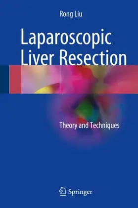 Liu |  Laparoscopic Liver Resection | Buch |  Sack Fachmedien