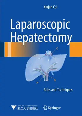 Cai |  Laparoscopic Hepatectomy | Buch |  Sack Fachmedien