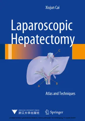 Cai | Laparoscopic Hepatectomy | E-Book | sack.de