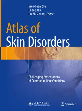 Zhu / Tan / Zhang |  Atlas of Skin Disorders | eBook | Sack Fachmedien