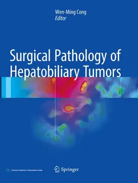 Cong |  Surgical Pathology of Hepatobiliary Tumors | Buch |  Sack Fachmedien