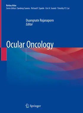 Rojanaporn |  Ocular Oncology | eBook | Sack Fachmedien
