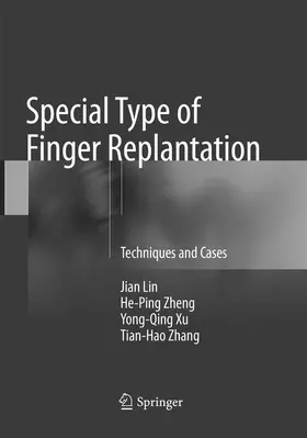 Lin / Zhang / Zheng |  Special Type of Finger Replantation | Buch |  Sack Fachmedien