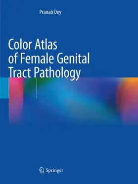 Dey |  Color Atlas of Female Genital Tract Pathology | Buch |  Sack Fachmedien