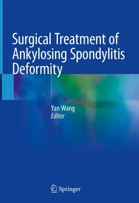 Wang | Surgical Treatment of Ankylosing Spondylitis Deformity | Buch | 978-981-13-6426-6 | sack.de