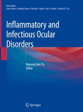 Yu |  Inflammatory and Infectious Ocular Disorders | eBook | Sack Fachmedien