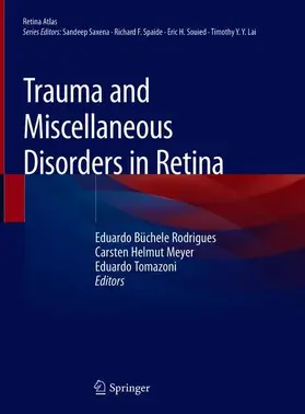 Rodrigues / Tomazoni / Meyer |  Trauma and Miscellaneous Disorders in Retina | Buch |  Sack Fachmedien