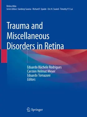 Rodrigues / Meyer / Tomazoni |  Trauma and Miscellaneous Disorders in Retina | eBook | Sack Fachmedien