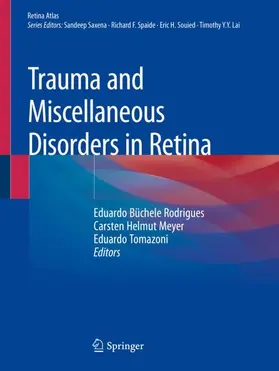 Rodrigues / Tomazoni / Meyer |  Trauma and Miscellaneous Disorders in Retina | Buch |  Sack Fachmedien