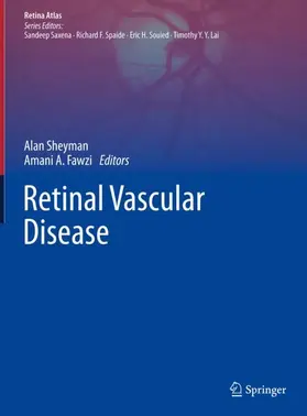Sheyman / Fawzi |  Retinal Vascular Disease | Buch |  Sack Fachmedien