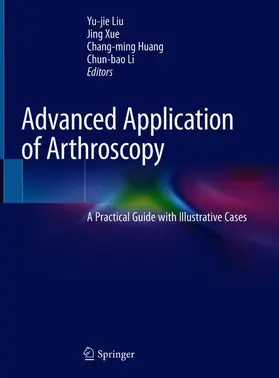 Liu / Li / Xue |  Advanced Application of Arthroscopy | Buch |  Sack Fachmedien