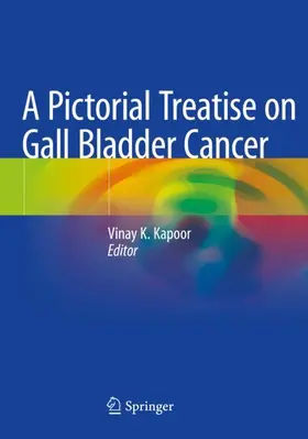 Kapoor |  A Pictorial Treatise on Gall Bladder Cancer | Buch |  Sack Fachmedien