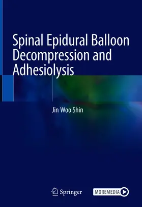 Shin |  Spinal Epidural Balloon Decompression and Adhesiolysis | eBook | Sack Fachmedien