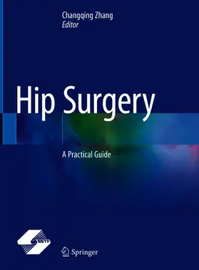 Zhang | Hip Surgery | E-Book | sack.de