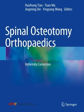 Tian / Wang / Ma | Spinal Osteotomy Orthopaedics | Buch | 978-981-16-1389-0 | sack.de