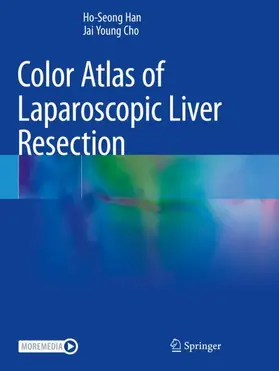 Cho / Han | Color Atlas of Laparoscopic Liver Resection | Buch | 978-981-16-1548-1 | sack.de