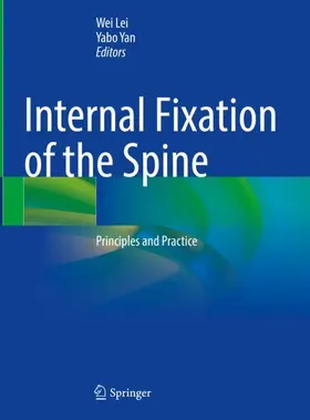 Yan / Lei |  Internal Fixation of the Spine | Buch |  Sack Fachmedien