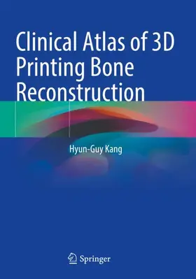 Kang |  Clinical Atlas of 3D Printing Bone Reconstruction | Buch |  Sack Fachmedien