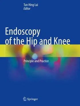 Lui | Endoscopy of the Hip and Knee | Buch | 978-981-16-3490-1 | sack.de