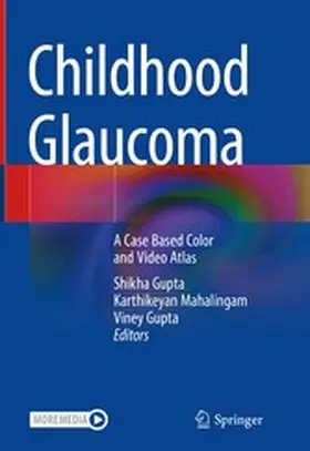 Gupta / Mahalingam |  Childhood Glaucoma | eBook | Sack Fachmedien