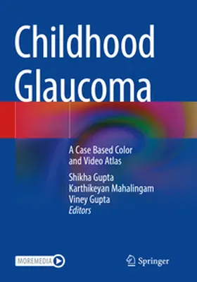 Gupta / Mahalingam |  Childhood Glaucoma | Buch |  Sack Fachmedien