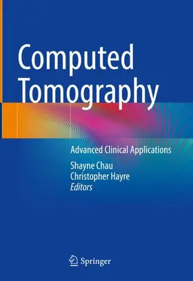 Chau / Hayre |  Computed Tomography | Buch |  Sack Fachmedien