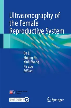 Li / Na / Wang |  Ultrasonography of the Female Reproductive System | Buch |  Sack Fachmedien