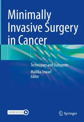 Tewari |  Minimally Invasive Surgery in Cancer | Buch |  Sack Fachmedien