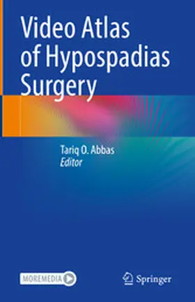 Abbas | Video Atlas of Hypospadias Surgery | E-Book | sack.de
