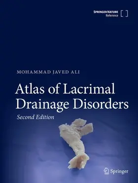 Ali |  Atlas of Lacrimal Drainage Disorders | Buch |  Sack Fachmedien