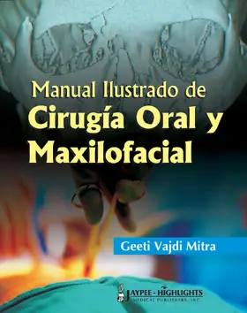 Mitra | Manual Ilustrado de Cirugia Oral y Maxilofacial | Buch | 978-9962-67-836-6 | sack.de